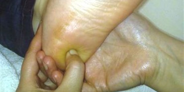 Refleksoloji, engellilerin tedavisinde umut oluyor