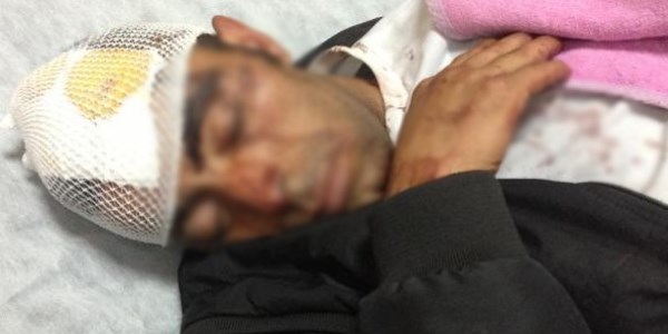Kızıyla görüşen genci, sopalarla dövdüler