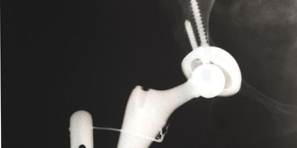 Doktoru özel hastaneye geçince ameliyat olamadı
