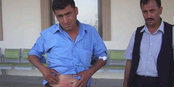 Ahırı temizlerken kene ısırdı