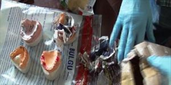 Kolideki diş protezlerinin içinden esrar çıktı