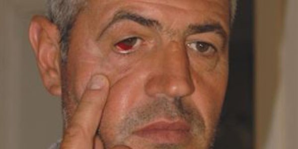 Sosyal medyadan eleştiriye dayak iddiası