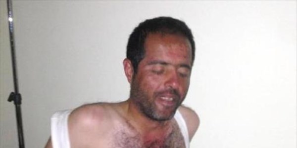 Kayıp işçi, 15 gün söğüt yaprağı ve elma yiyerek hayatta kaldı