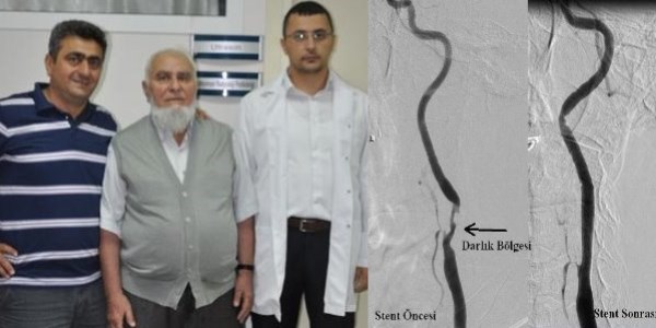 Düzce Üniversite Hastanesinde bir ilk