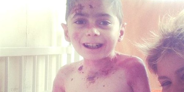 Gülben Ergen'den cilt hastası kardeşlere ziyaret