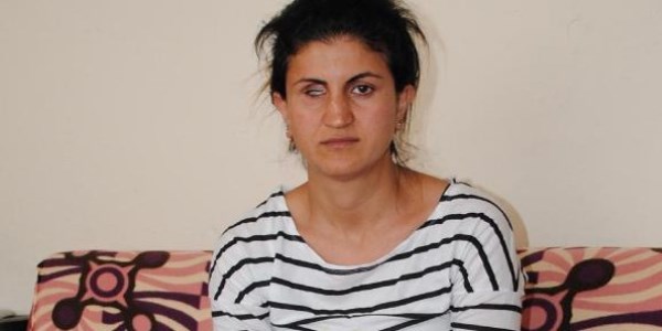 Semra'nın tek isteği protez bir göz