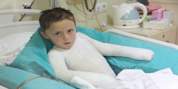 Süt kazanına düşen çocuk ölümden döndü