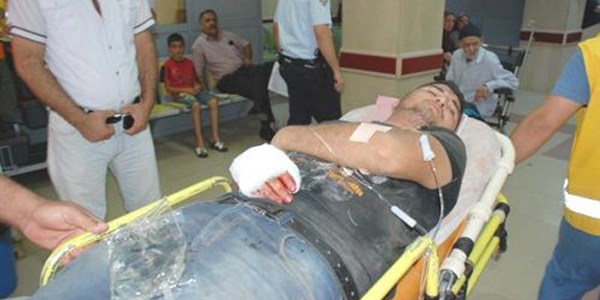 Un değirmenine elini kaptıran işçi yaralandı