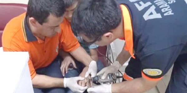 Acil serviste yüzük kesme operasyonu