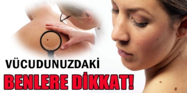 Vücudunda çok sayıda 'ben'i olanlar dikkat!