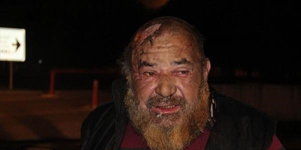 Isınmak için yaktığı ateşle hem kendini hem vagonu yaktı