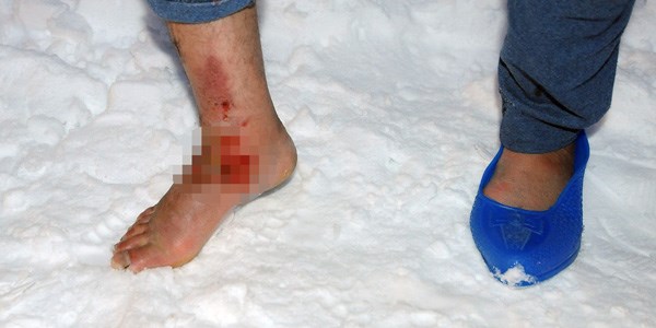İl Özel İdaresi, zihinsel engelli kadını kurtardı
