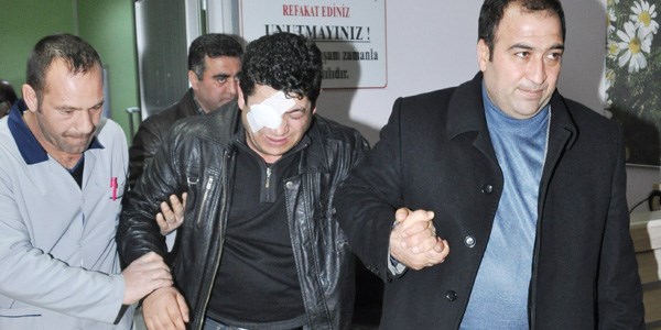 Yanıcı sıvıyla polisin yüzünü ve gözünü yaktı