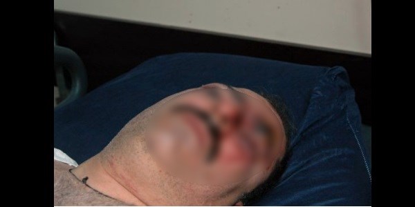 Mansur Yavaş'ı eleştirdi, komalık oldu