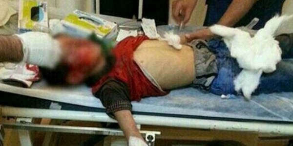 10 yaşındaki Mehmet Ezer gaz kapsülüyle vuruldu