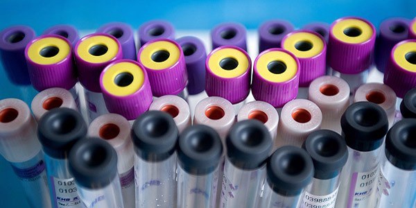 Hepatit C'de tam iyileşme mümkün olacak
