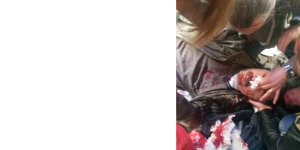 Polis öğretmene dipçikle vurdu