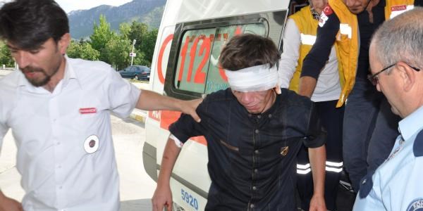 Stajyerinin kulağını ısırarak hastanelik etti