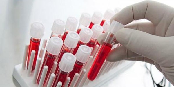 Tüm kanserler için tek test!