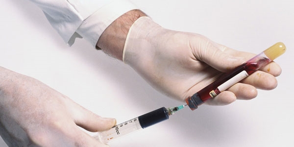 Hepatit B, AIDS'ten 100 kat daha bulaşıcı