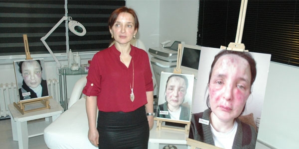 Sahte doktor kurbanı kadının yüzünde şaşırtan değişim