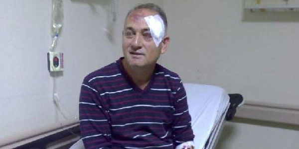 CHP'li belediye başkanına yumruk