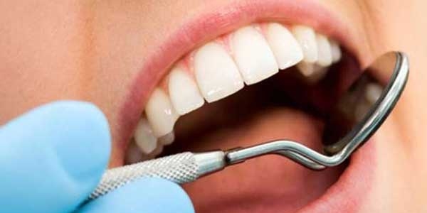 20 yaş dişleri çekilmek zorunda mı?
