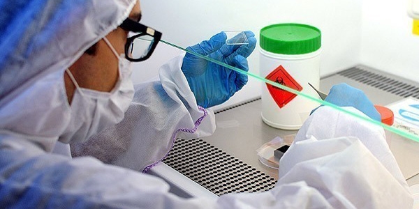 Ebola dakikalar içerisinde test edilebilecek