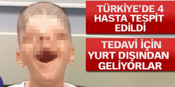 Bu ölümcül hastalığı Türk uzmanlar keşfetti!