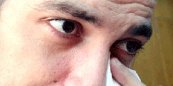 Gözünüz nasıl yaşlanır?