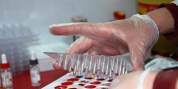 Türk Kızılayı'nın kök hücrede hedefi 250 bin bağış