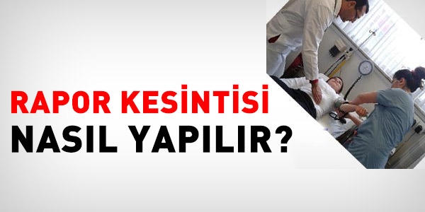 Rapor kesintisi nasl uygulanr?