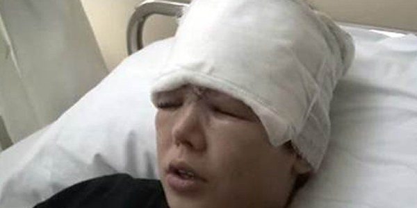 Deney yaralanmasında öğretmene 1 yıl hapis istemi