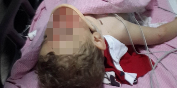 Balkondan düşen 4 yaşındaki çocuk ağır yaralandı