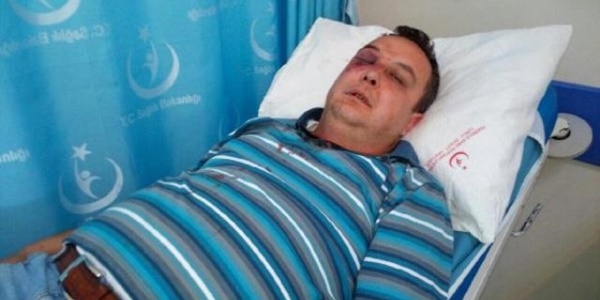Suyu kesilen şahıs, belediye çalışanlarını hastanelik etti