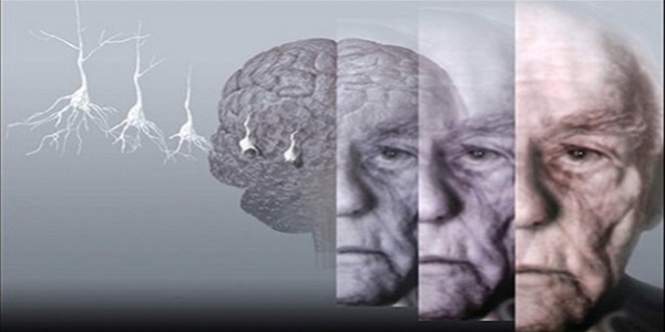 Alzheimer 18 yıl önce teşhis edilebiliyor