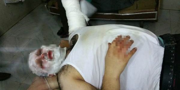 AA muhabiri Suriye'deki fze saldrsnda yaraland