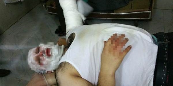 AA muhabiri Suriye'deki füze saldırısında yaralandı