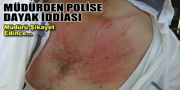 Polis memuru amirinden dayak yedim diye şikayetci oldu