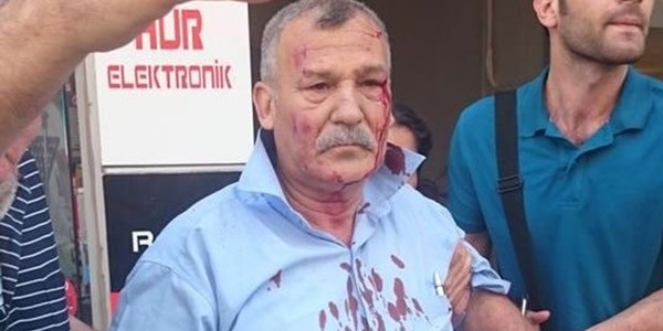 İki saldırıdan sağ kurtuldu