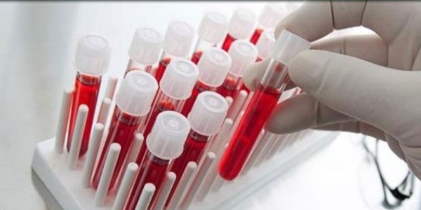 100 hastaln nedeni zararl moleklleri tespit eden test