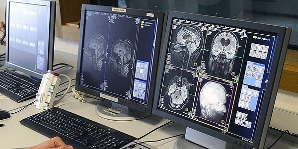 Türk bilim ekibi beynin sırlarını çözme yolunda