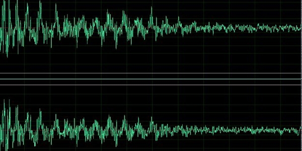 Bilim adamlar ses dalgalaryla beyni kontrol etti