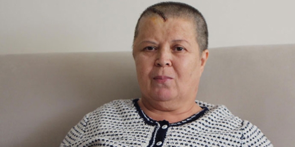 'Makine bozulunca beyin ameliyatı yarıda kaldı'