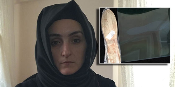 Ameliyat olan kadının karnında mala unuttular