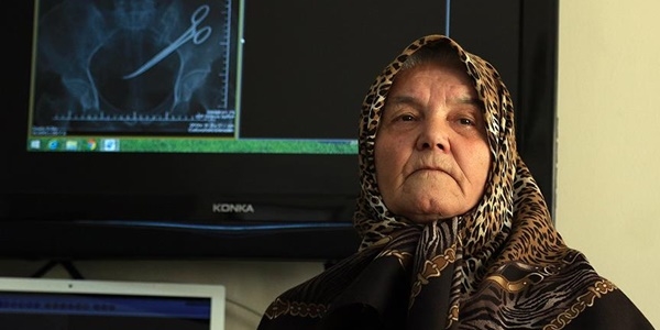 Karnında unutulan makasla 5 yıl yaşadı!