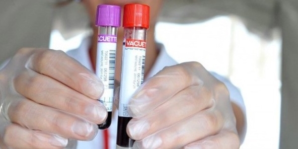 Öğrenme güçlüğüne karşı kan testi