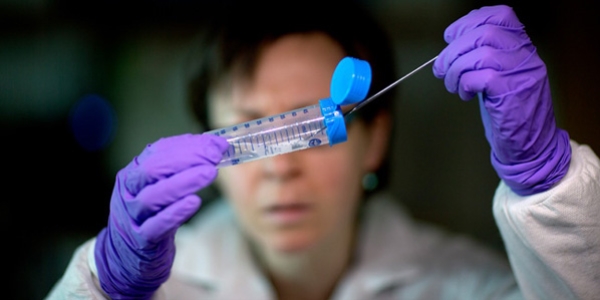 37 milyon kişi HIV virüsü taşıyor