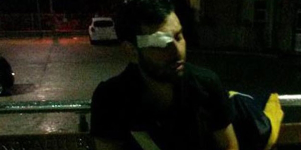 Kocaeli'de üniversite öğrencisini döverek hastanelik ettiler