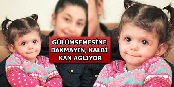 1 yaşındaki Fatma bebeğin yüzü 'gülse' de kalbi 'kan ağlıyor'
